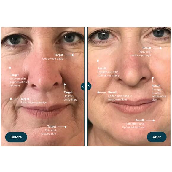 Skintific 7in1 LED Xtra Strength Wand Reduces Wrinkles Boosts Collagen & Elastin - Picture 2 of 16